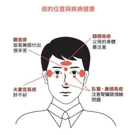 陰部長痣|臉上有痣一定要點掉嗎？命理師大師：錯！「這兩種」。